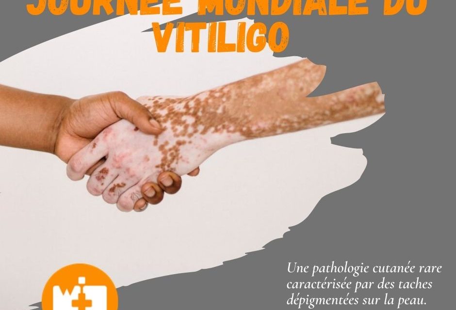 https://blog.workinpharma.fr/wp-content/uploads/2021/06/Journee-mondiale-du-Vitiligo-940x640.jpg