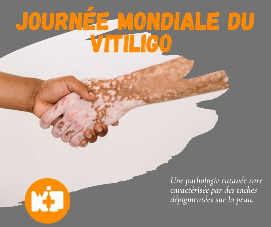 https://blog.workinpharma.fr/wp-content/uploads/2021/06/Journee-mondiale-du-Vitiligo.jpg